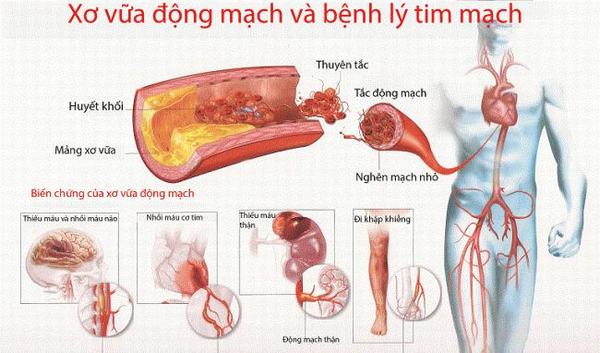 mau-nhiem-mo3
